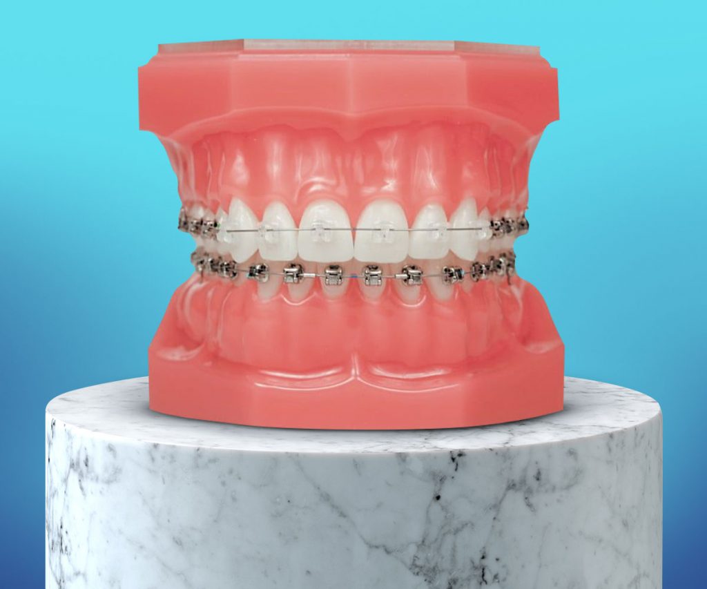 Damon Clear Denta Care