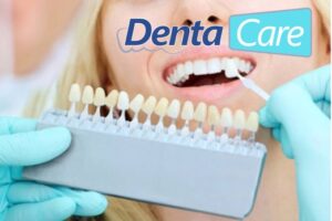11 Beneficios del Blanqueamiento Dental Profesional