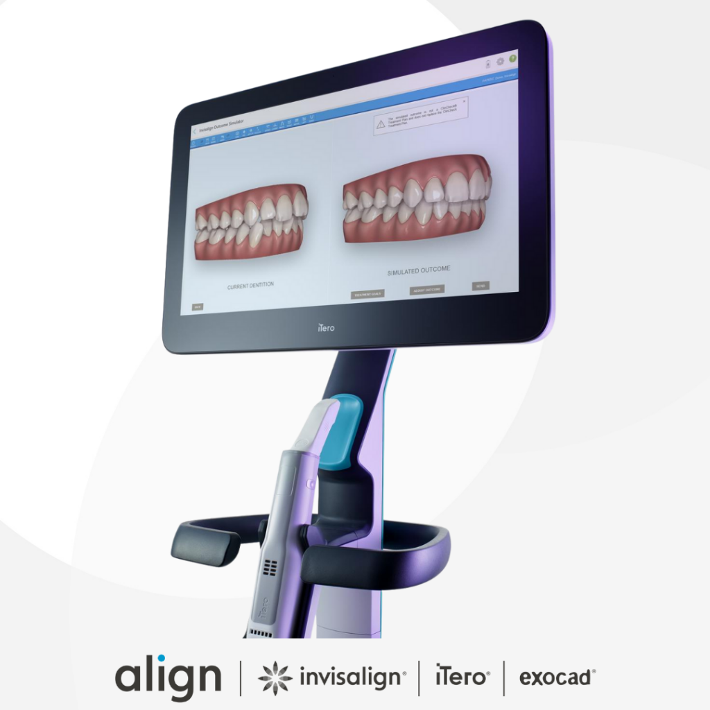 Itero El Escaner 3d De Invisalign Denta Care 2433