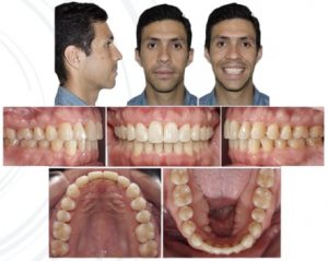 Revista boliviana de ortodoncia