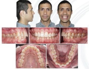 Revista boliviana de ortodoncia
