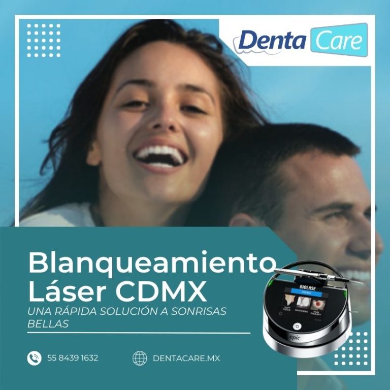 Ven a tu Blanqueamiento Dental con Láser en CDMX Denta Care