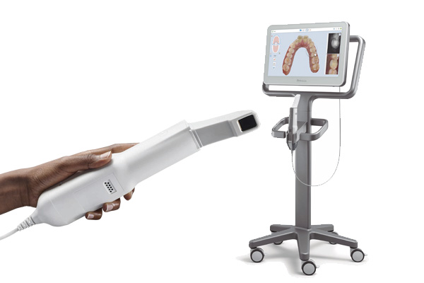 ITERO SCANNER — Valiente Dental