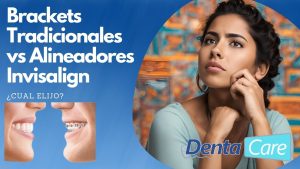 Brackets tradicionales vs alineadores Invisalign