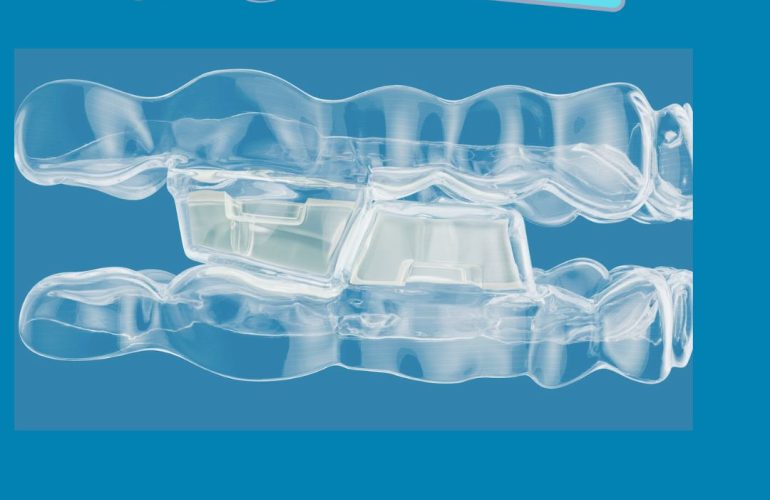 Bloques Oclusales de Invisalign
