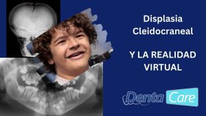 displasia cleidocraneal