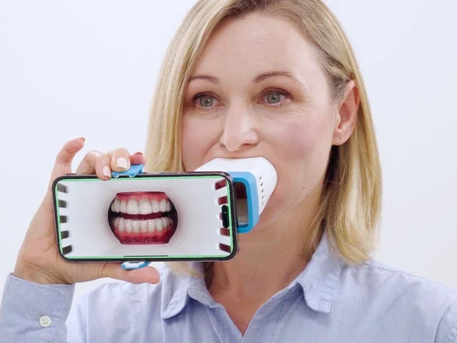 Invisalign Virtual Care AI