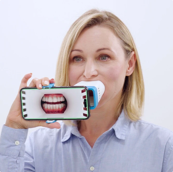 Invisalign Virtual Care AI