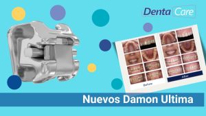 Damon Ultima