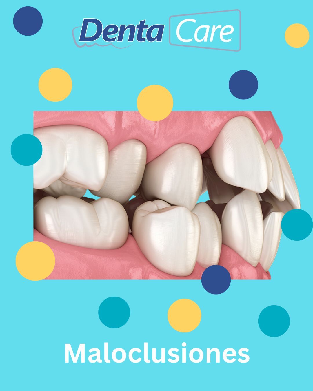 Maloclusiones