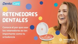 Retenedores Dentales 