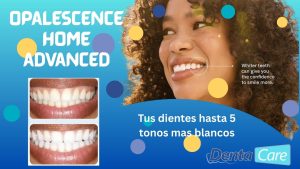 Opalescence Home Advanced