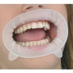 OptraGate 2