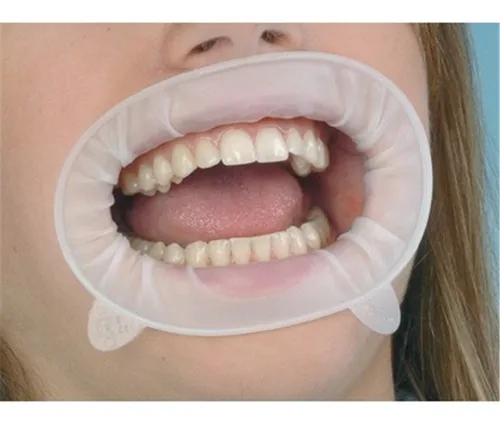 OptraGate 2