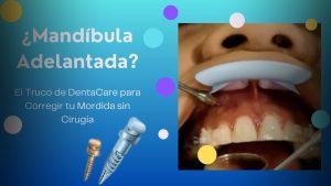 Invisalign & Microtornillos